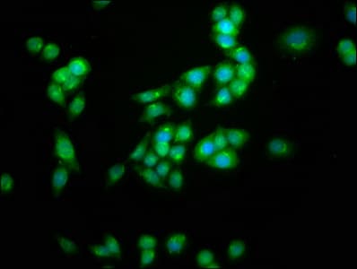 Polyclonal Rabbit anti-Human KCNC3 / Kv3.3 Antibody (IHC, IF)