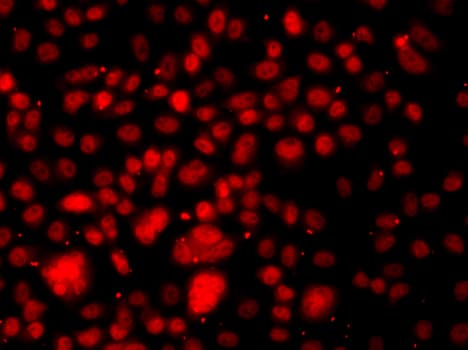 RELA / NFKB p65 Antibody