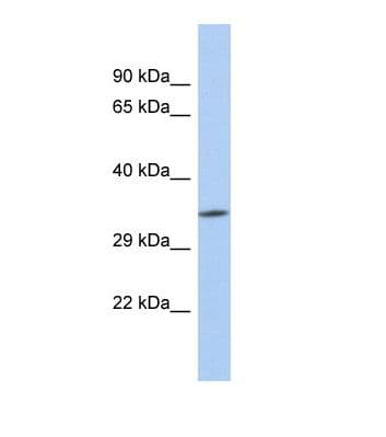 ZC3H3 Antibody (N-Terminus)