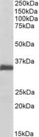 PathPlus™ Polyclonal Goat anti-Human EFNB2 / Ephrin B2 Antibody (aa62-74, IHC, WB)