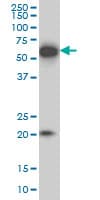 IHC-plus™ Monoclonal Mouse anti-Human EBF3 / COE3 Antibody (clone 8D6, IHC, WB)
