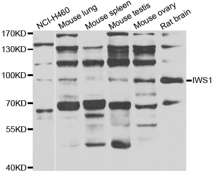 Polyclonal Rabbit anti-Human IWS1 Antibody (IHC, IF, WB)