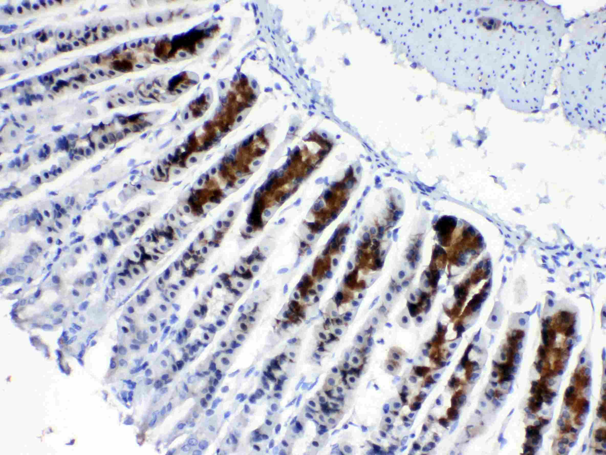 ALCAM / CD166 Antibody
