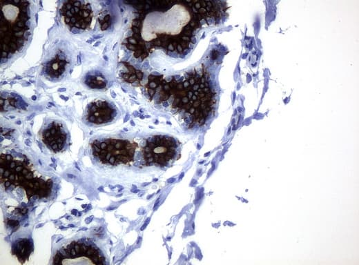 KRT19 / CK19 / Cytokeratin 19 Antibody (aa240-390, clone UMAB3, Carrier-free)
