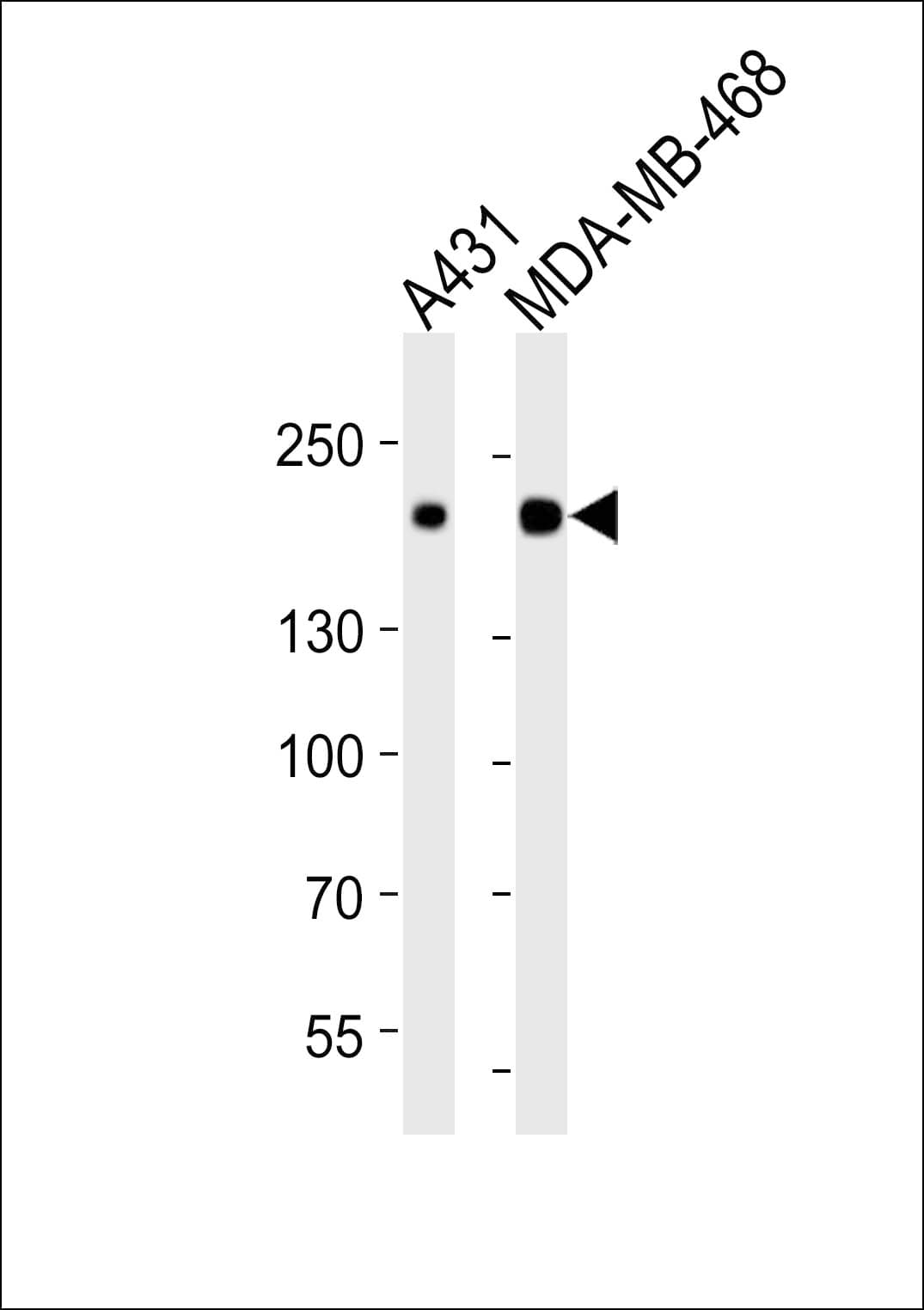 EGFR Antibody (clone 51CT78.40.5)