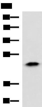 Polyclonal Rabbit anti-Human ABHD14B Antibody (IHC, WB)