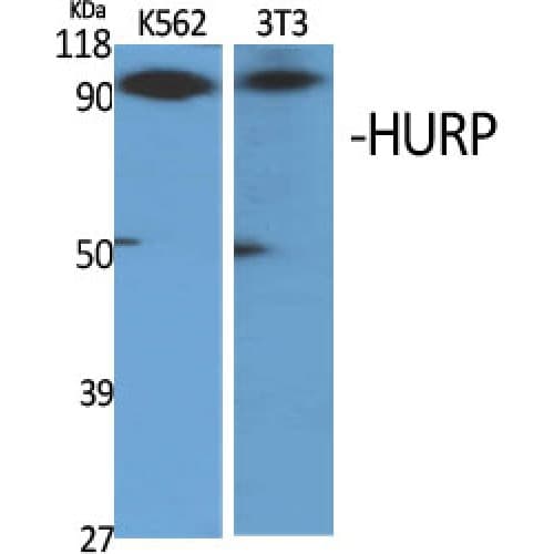 Polyclonal Rabbit anti-Human HURP / DLGAP5 Antibody (760-840 aa, C-terminal, WB)