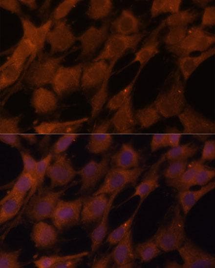 LGMN / Legumain Antibody