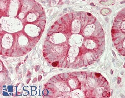 IHC-plus™ MARCKSL1 Antibody (aa145-195)