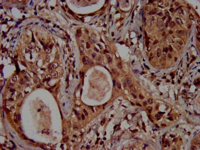 Polyclonal Rabbit anti-Human HIST1H3A Antibody (IHC, IF)