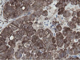 MIPEP Antibody (aa174-516, clone OTI5E7, Carrier-free)
