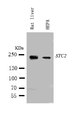 Tuberin / TSC2 Antibody (aa1605-1620)