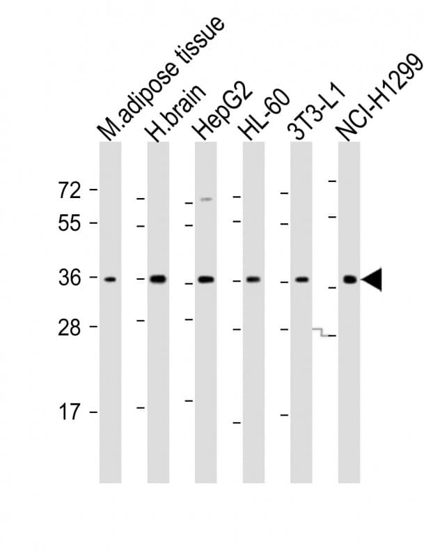 Polyclonal Rabbit anti-Human ADRB3 Antibody (aa255-289, WB)