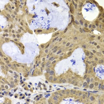 TERF2IP / RAP1 Antibody