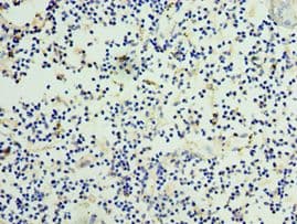 CCN3 / NOV Antibody (aa32-357)