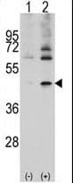 Polyclonal Rabbit anti-Human ACTB / Beta Actin Antibody (aa189-218, IHC, WB)