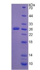Human NEU1 / NEU Protein (Recombinant His, N-Terminal)