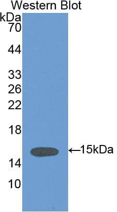 VCL / Vinculin Antibody