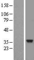 CENPO Protein (Over-Expression Lysate Myc-DDK (Flag))
