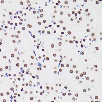 H1F0 Antibody