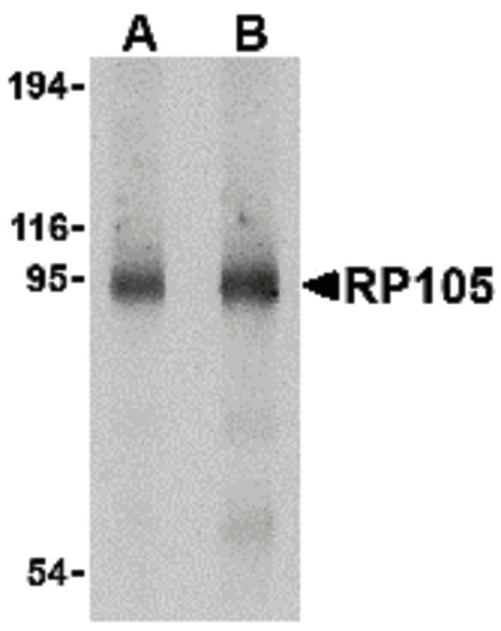 RP105 / CD180 Antibody