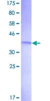 Human C1orf38 Protein (Recombinant GST)