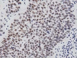 PTPRE / PTP Epsilon Antibody (clone OTI3H3)