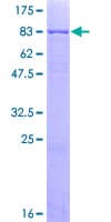 Human NLK Protein (Recombinant GST)