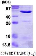 Human ANXA7 / Annexin VII / SNX Protein (Recombinant His)