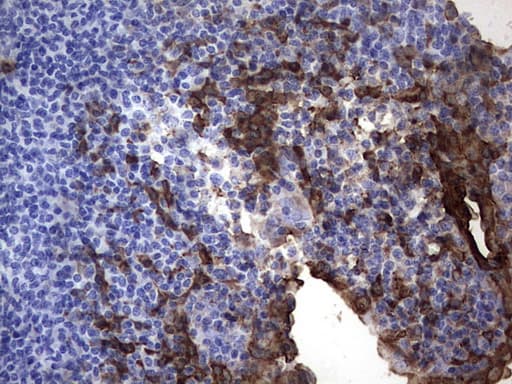 S100A9 / MRP14 Antibody (clone OTI7B1)