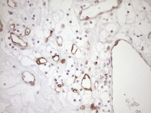 Monoclonal Mouse anti-Human BLNK Antibody (clone OTI4C9, aa1-292, IHC, WB)