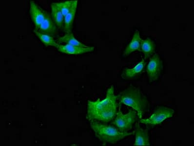 NAT1 / AAC1 Antibody