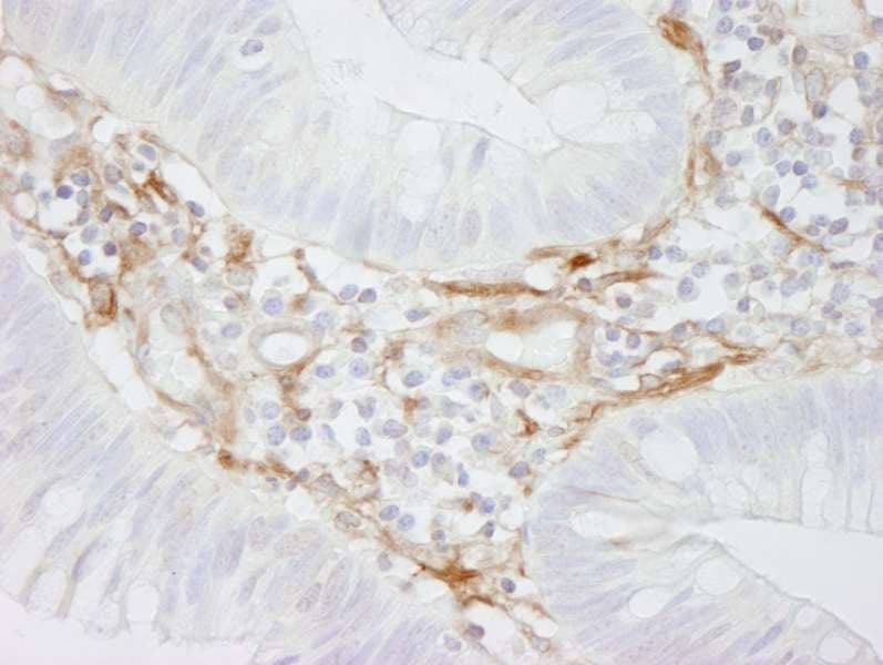 FLNA / Filamin A Antibody (aa1725-1775)