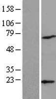 Human ARPC4 Protein (Over-Expression Lysate Myc-DDK (Flag))