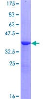 Human NPHP1 / Nephronophthisis Protein (Recombinant GST)