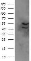 IHC-plus™ Monoclonal Mouse anti-Human DIXDC1 Antibody (clone 6B6, IHC, IF, WB)