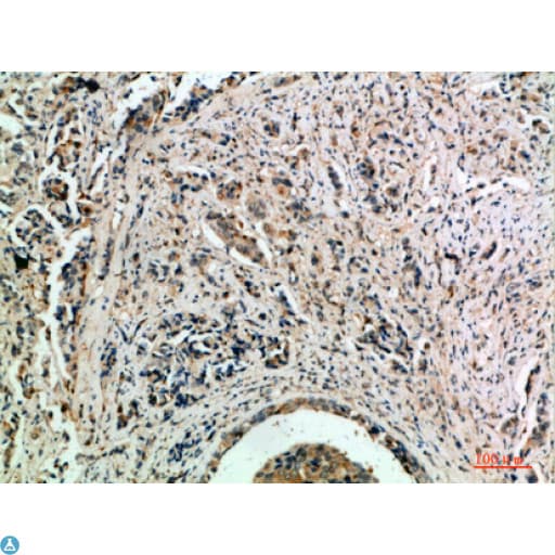 TLE1 / TLE 1 Antibody