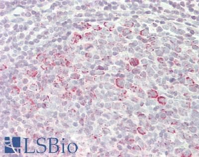 IHC-plus™ GADD45A / GADD45 Antibody (aa1-30)