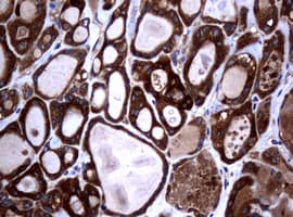 NME1 / NM23 Antibody (clone OTI24A2)