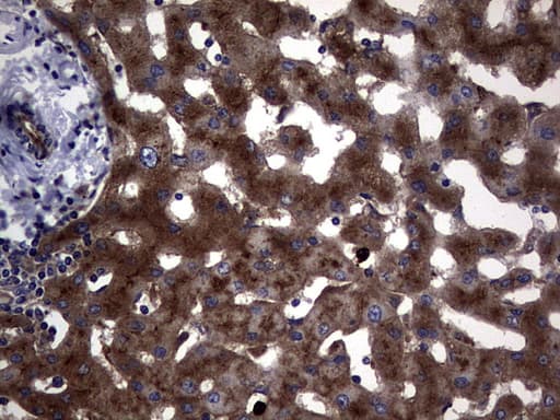 Monoclonal Mouse anti-Human CEACAM5 / CD66e Antibody (clone OTI5F2, aa35-680, IHC, WB)
