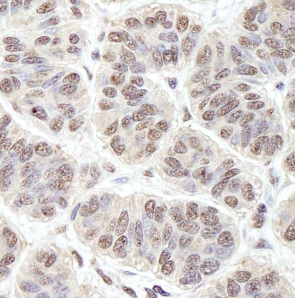PRKRIR Antibody (aa150-200)
