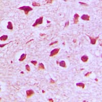 RANBP6 Antibody (Internal)