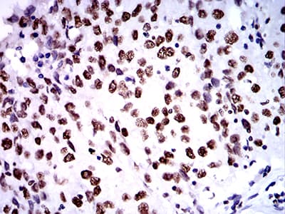 ZFP91 Antibody (clone 8C3D5)
