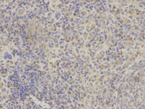 GRIA3 / GLUR3 Antibody