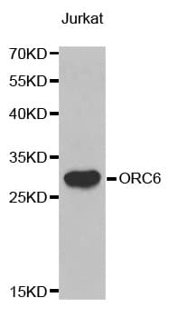 ORC6 / ORC6L Antibody