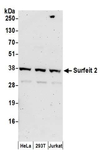 SURF2 / SURF-2 Antibody (aa175-225)