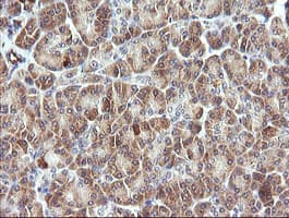 Monoclonal Mouse anti-Human PIK3R5 Antibody (clone OTI4G9, IHC, IF, WB)