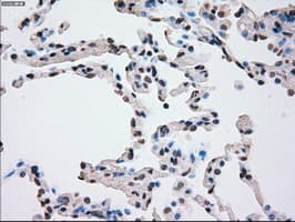 PLK1 / PLK-1 Antibody (clone OTI5C1)