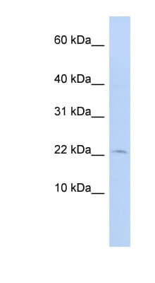 Polyclonal Rabbit anti-Human FKBP2 Antibody (N-Terminus, WB)