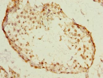 SST / Somatostatin Antibody